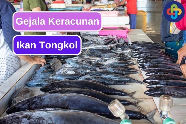 Inilah Gejala Keracunan Tongkol Yang Perlu Diperhatikan